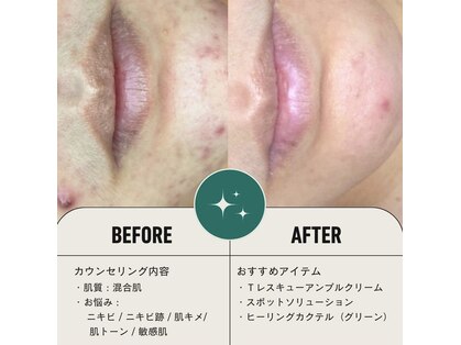 エミレーブ シロカネ(Hemireve Shirokane)の写真