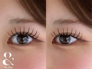フィグ(fig)の写真/《まつげパーマ×マツエク》長持ち感にもこだわる目元へ。