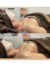 カシェット(cachette)/ミラクルバストプレミアム