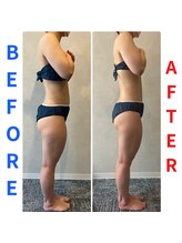 ハレアンド(Hare&)/痩身エステで理想の体型に