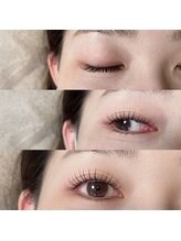 デイジー(DAY'S EYE)/エクぱ