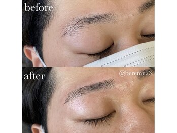 ベリーム(bereme)/ハリウッドブロウリフト20代