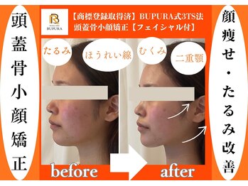 ブプラ 沖縄那覇店(BUPURA)