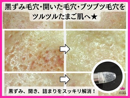 サロン ド ボーテ プルーラ(Salon de beaute PLURA)の写真