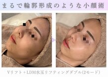 アマテラススキンラウンジ(Amatelas SKIN LOUNGE)