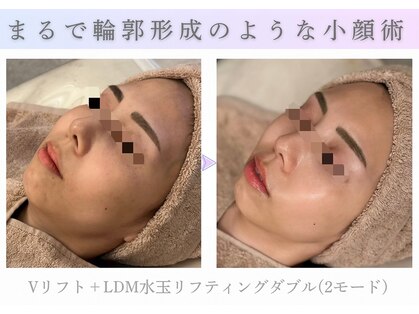 アマテラススキンラウンジ(Amatelas SKIN LOUNGE)の写真