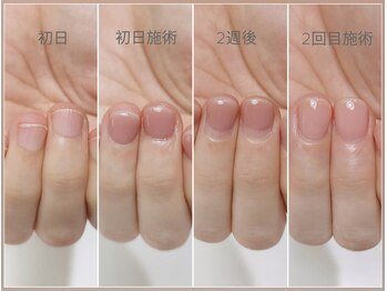 ミンスネイル(Mins Nail)/