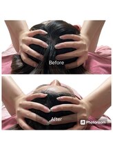 スカイ(sky)/頭蓋骨立体小顔矯正