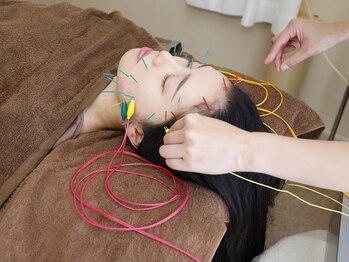 ハリュウ 新越谷/美容鍼灸