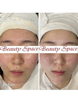 ビューティースペース 松戸店/