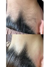 アンジェム(Angem)/初回ビフォーアフター