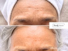 ビューティー ブロッサム(Beauty Blossom)/