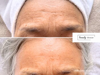 ビューティー ブロッサム(Beauty Blossom)/