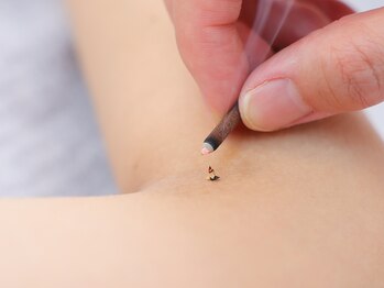 鍼灸イズン/身体の鍼