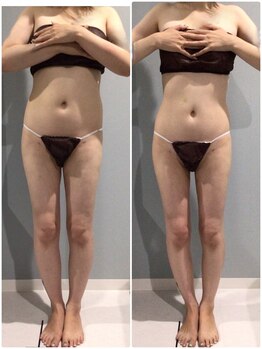 アイ アンド ネイル(Eye＆Nail Day)/痩身コース☆