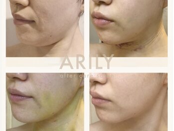 アリリィ(ARILY)/ARILY after care salon