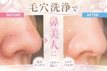 【毛穴洗浄/肌質改善/ピーリング/フェイシャル】 &nbsp;SOW