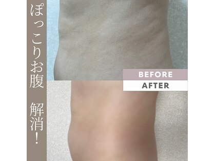 フォレデフィ(Foret de Fees)の写真