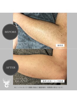 グランズ 芦屋(GLANZ)/Before→After