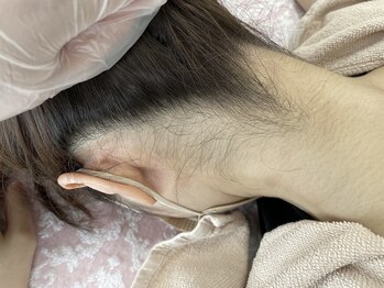 ルナベイビー 金山店(Luna Baby)/うなじワックス/うなじワックス