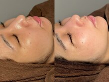 ルーナジェーナ(Luna llena)/池袋　エステ　ルーナジェーナ