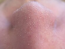 ヒスイ バイ アメイジング(Hisui by AMAZING)/【毛穴ケア】韓国式3D毛穴洗浄