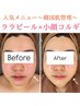 【話題沸騰！人気★韓国肌管理】小顔コルギ&ララピール通常価格¥26400