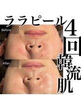 フルブルーム(Full Bloom)/ララピール &nbsp;肌質改善