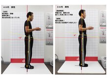 ほねつぎ 府中鍼灸整体院/【症状】ストレートネック