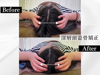 ポーベルポー(Peau Belle poe)/【自律神経整う】深層頭蓋骨矯正