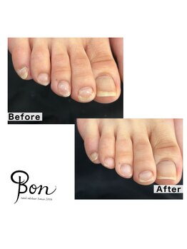 ネイルアトリエ ボン(nail atelier bon)/フットケア