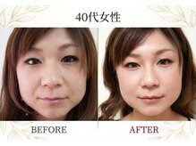 Nine9【ナイン】の雰囲気(筋膜リリースマッサージでお顔全体がスッキリ)