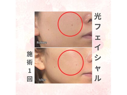 フォルチェ 三川町(Folche)の写真