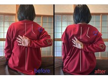 福岡いちふつうの整体院の雰囲気（重い肩こりや長年続く腰痛も二人三脚で原因からしっかり改善◎）