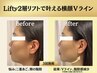 最新高周波Lifty2層リフト×ヘッドスパ◆横顔Vライン形成￥18,800