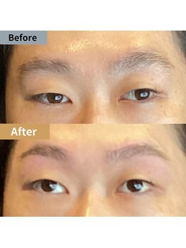 眉毛ハウス 吉祥寺店(眉毛HOUSE)/お客様の施術例(吉祥寺/東京)