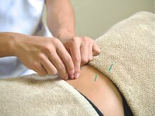つなぐ/痛みや凝りの鍼灸施術