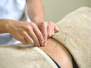 つなぐ/痛みや凝りの鍼灸施術
