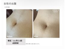 リネ(Rine)/before→after