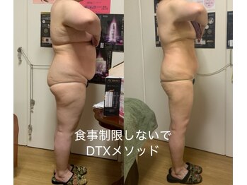 アレビュー(Arebeau)