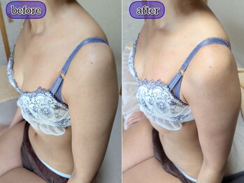 スノードロップ(snowdrop)/