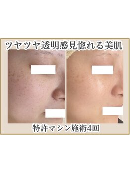 お肌をきれいにしたい