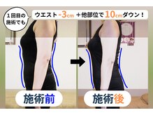 レシカの雰囲気(1度の施術でも効果を実感いただくことが可能です。)