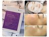 人気No.3ニキビ肌・アクネ菌殺菌・美肌 プラズマ×高濃度炭酸導入7500→6500