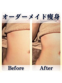 美庵 池袋店の写真/【サイズダウン】インディバ×新型ハイパーナイフ7正規取扱サロン【ハイパー+インディバ+リンパ】100分