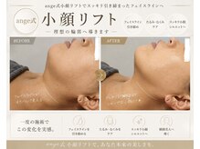 アンジェ(ange)の雰囲気（【小顔/脂肪分解/リフトアップ/二重あご/むくみ/たるみケア】）