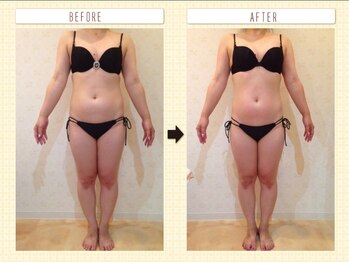 カロン(Kalon)/痩身