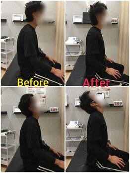 くすの樹接骨院 整体院 吉野ヶ里院/整体/骨盤矯正ビフォーアフター