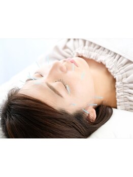 鍼灸施術を受けたい