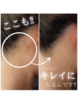 ボーテ ドゥ ランジュ(BEAUTE DE L’ANGE.)/【背面美人】